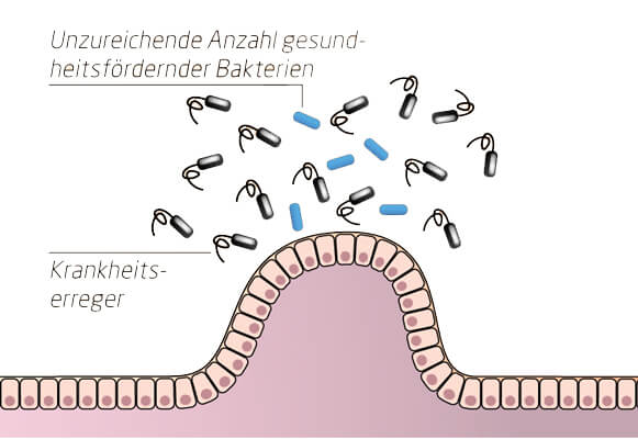 Reizdarmsyndrom Rds Wie Erkenne Und Behandle Ich Es